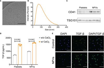 Platelet Derived Vesicles Enhance the TGF-beta Signaling Pathway of M1 Macrophage